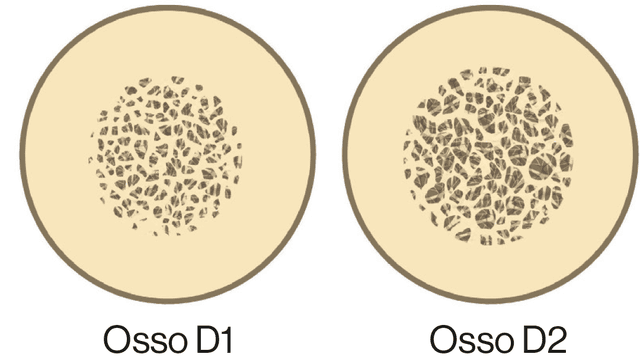 Procedura D1/D2