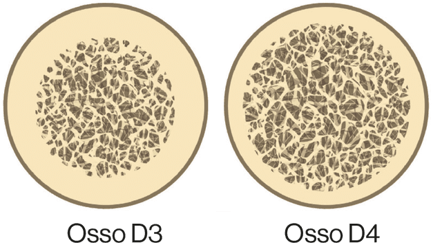 Procedura D3/D4