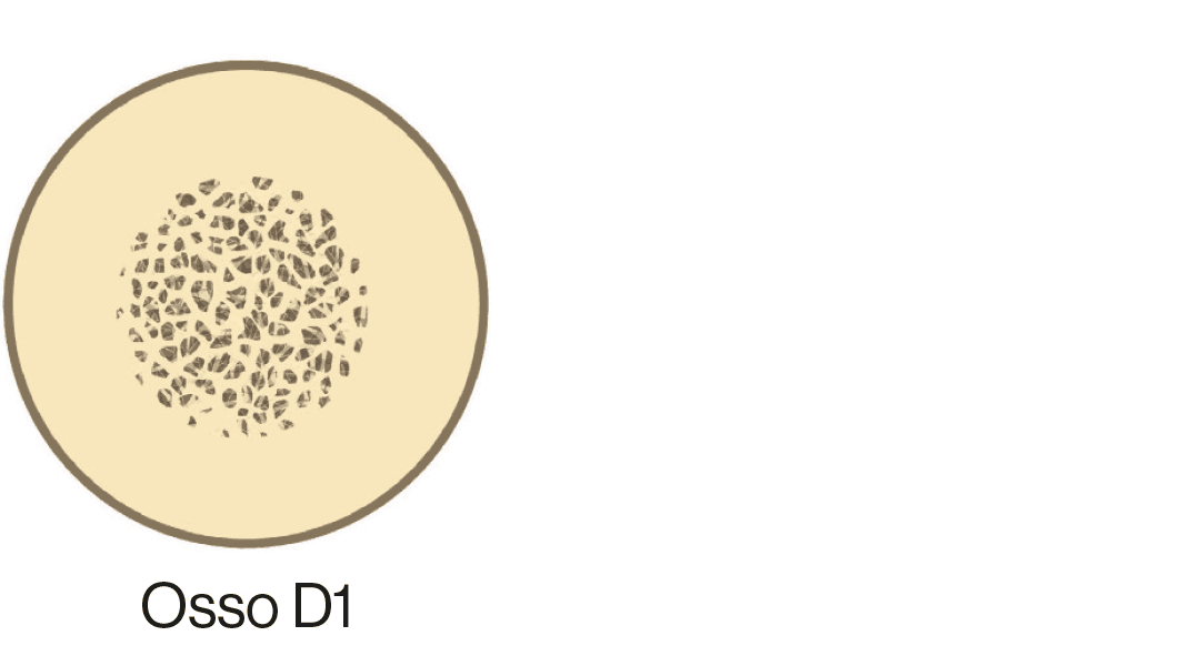 osso-d1