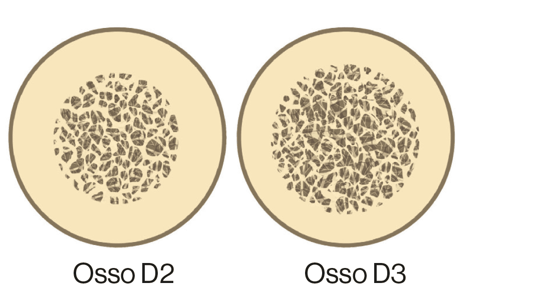 osso-d3
