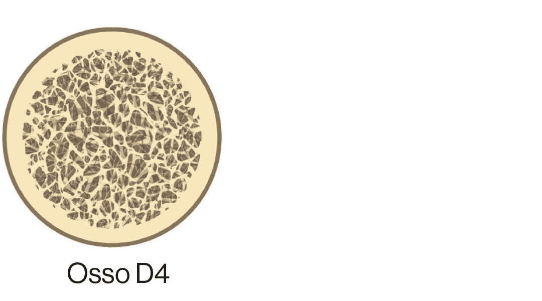 osso-d4